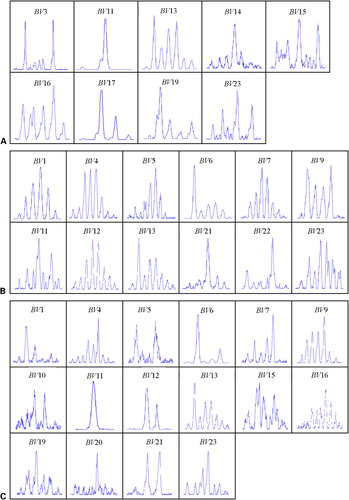 Figure 2. CDR3 analysis of TRBV families in (A) PBMCs, (B) CD4+ and (C) CD8+ T cells from one CML case (C12). Clonally expanded T cells can be seen in families: BV11 (A, C), BV6 (B, C) and BV21 (B).