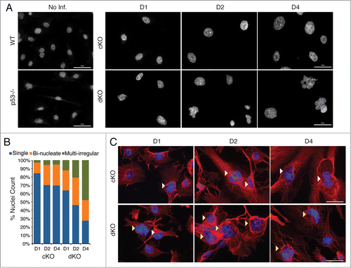 Figure 3. Simultaneous loss of p53 aggravates the aberrant nuclear morphological phenotypes of Hinfp-ablated cells. (A) IF microscopy reveals drastic changes in nuclear size and shape of cKO MEFs that are exacerbated in dKO MEFs. Nuclei stained with DAPI show increased appearance of irregularly shaped morphology in cells lacking both p53 and Hinfp. Scale Bar 50µm. (B) The bar graph shows distribution of different nuclear morphologies in cKO and dKO MEFs (n = 200 ). (C) IF microscopy of cKO and dKO MEFs stained with α-Tubulin (red) shows increased presence of bi-nucleated cells (white arrowheads) in cKO MEFs. The dKO MEFs have an enhanced phenotype with higher incidence of irregularly shaped fused nuclei (yellow arrowheads). Scale Bar 50 µm.