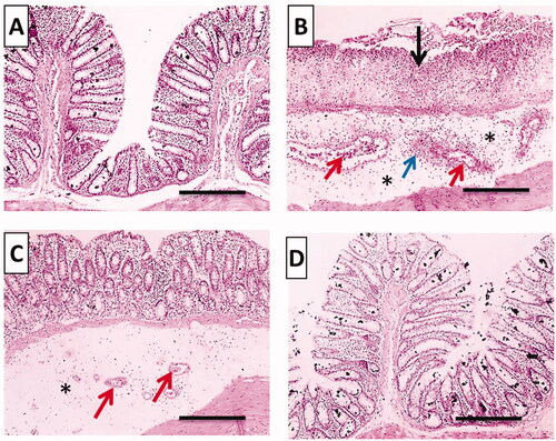 Figure 10. Histopathological examination (hematoxylin and eosin stained, ×100) of colonic tissues after acetic acid-induced colitis in rats. (A) Normal group; (B) positive control group; (C) TMB group; (D) TMB-NLC group. Mucosal necrosis and ulceration (black arrow), congestion (red arrows), inflammatory cells infiltration (blue arrow), and edema (black asterisk).