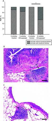 Figure 4.  Pulmonary lymphoid follicles. Percentage of individuals with presence or absence of lymphoid follicles in lung tissue of control and CS-exposed groups (A).* p < 0.05 (Fisher exact test). Photomicrographs of lymphoid follicle (arrows) in peribronchial (B) and perivascular (C) lung tissue of CS-exposed guinea pigs at 6 months (H&E stain. Scale bar, 100 mm).