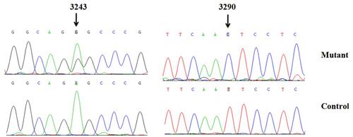Figure 3 Identification of tRNALeu(UUR) A3243G and T3290C variants by direct sequence.