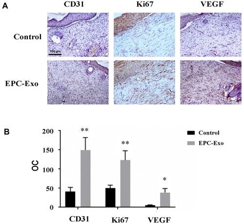 Figure 4 Immunohistochemical staining of skin wound tissue treated with EPC-derived exosomes in diabetic mice. Representative immunohistochemical images (A) and summary data (B) of immunostaining in skin wound tissue obtained from diabetic mice treated with EPC-derived exosomes or PBS (control), expressed as integrated optical density/total area (OC) (magnification, 200×). All values are presented as means and standard deviations (n = 3). Statistically significant differences are indicated by *P < 0.05 and **P < 0.01, compared with the control group.