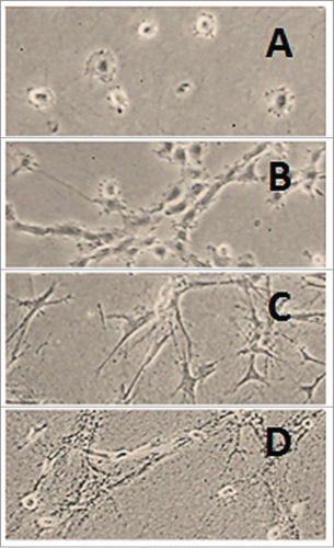 Figure 2. Rat liver myofibroblasts on attached collagen gel. Rat liver MFB were cultured on type I collagen gel. Cells (A) 1 h, (B) 2 h and (C) 24 h after seeding on the gel. The cells were rounded at first but they soon became stellate and aggregated. The gel was detached from the walls and the bottom of the dish 24 h after seeding the cells and the cells were allowed to grow for another 24 h (D) (Peterová and Kanta, unpublished results).