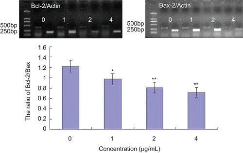 Figure 6.  Effect of Aikete injection on Bcl-2 and Bax mRNA expression in SMMC-7721 cells. Cells were treated with various concentrations of Aikete injection for 48 h. The mRNA levels of Bcl-2 and Bax were analyzed by RT-PCR, and actin was used as a control. Data were the mean ± SD of three independent experiments. Compare with negative control: *P < 0.05 **P < 0.01.