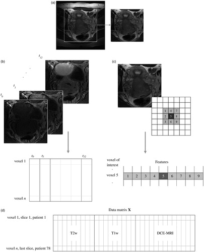 Figure 1. Conversion of the MR images into a data matrix X used for voxel classification. (a) Edges were removed from all images. (b) For the DCE-MRI series, each voxel was represented by the intensities of the 13 first time steps in the image series. (c) The T2w or T1w images were represented by either only their intensity, or by their intensity (dark grey) and the intensities of the eight closest neighbour voxels (light grey). (d) The data matrix X for the model based on T2w images with eight neighbours included, the T1w images with eight neighbours included and the 13 first DCE-MRI time steps.