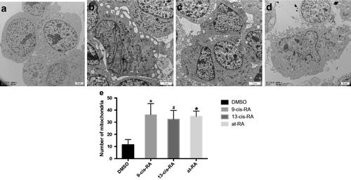 Figure 5. Ultrastructural images of SH-SY5Y cells treated with RAs. (a) Ultrastructural images of SH-SY5Y cells treated with DMSO for 7 days shows smooth edge, possessing larger nucleoli with regular shape. (b–d) Ultrastructural images of SH-SY5Y cells treated with 9-cis-RA, 13-cis-RA and at-RA, respectively for 7 days shows that the morphology of cells and nuclei are irregular, the nuclear–cytoplasmic ratios are decreased, and microvillus appear at the edge of cell membrane. (e) Average number of mitochondria of SH-SY5Y cells treated with DMSO, 9-cis-RA, 13-cis-RA and at-RA, respectively for 7 days. Five fields were selected for each group, each field containing at least one complete cell.