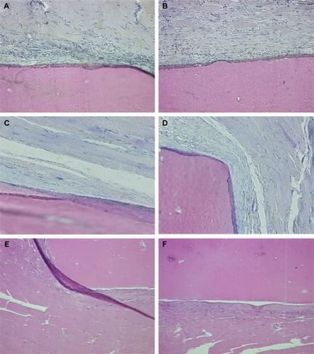 Figure 2 The HE staining of muscle implant operation.Notes: The HE staining of muscle implant operation at 4 weeks in the experimental group (A) and control group (B) (×200); 12 weeks in the experimental group (C) and control group (D) (×200); 24 weeks in the experimental group (E) and control group (F) (×200).Abbreviation: HE, hematoxylin and eosin.