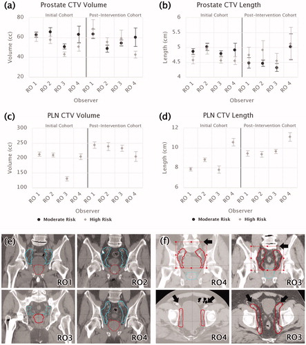 Figure 2. Mean structure volumes and lengths (with standard uncertainty of the mean) for (a, b) prostate and (c, d) PLN CTVs, stratified by RO and risk level. Initial and post-intervention cohorts are presented together for comparison. (e) Examples of representative mean PLN structures drawn by each RO in the retrospective cohort. (f) Examples of representative PLN contours drawn by RO 4 and RO 3 in the post-intervention cohort. Differences are indicated with arrows and structure limits with bounding boxes.