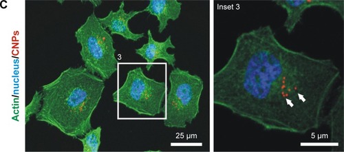 Figure 6 Depolymerization/repolymerization experiment performed in live HeLa cells containing CNPs.Notes: (A) Confocal microscopy image of HeLa cells containing CNPs (red channel, arrows). Repolymerizing microtubules (green channel) do not nucleate at the particles. (B) Fluorescence + phase contrast microscopy on HeLa cells treated with unlabeled CNPs (arrows). The CNT coating of the particle allows particle identification in the phase contrast image. No tubulin nucleation (red channel) is observed in the surroundings of the CNPs. Asterisks indicate the location of the centrosomes. (C) Actin nucleation (green channel) is not observed in the surroundings of the CNPs (arrows).Abbreviations: CNPs, CNT-bearing particles; CNT, carbon nanotube.