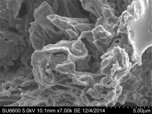 Figure 3 SEM of the study catheter material micro-patterning.