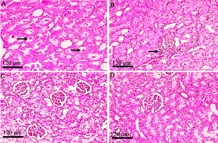 Figure 5. Histopathological view of rat renal sections in GEN + HDN (A–C) group and HDN alone (D) stained with haematoxylin and eosin (magnification ×100). (A) Sporadic hyaline casts in tubules (medulla); (B) mild mononuclear cell infiltration; (C) slight degenerative epithelial changes in glomeruli and tubules; and (D) normal structure of glomerulus and tubules.