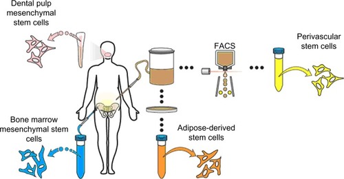 Figure 1 Representative sites of MSC isolation.