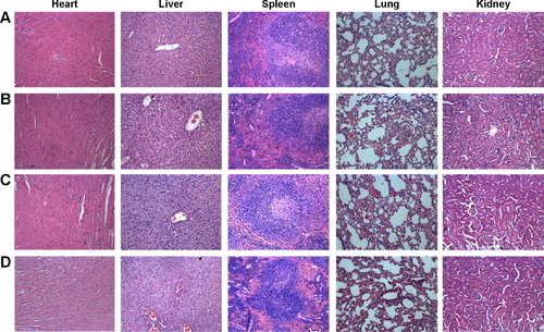 Figure S7 Hematoxylin and eosin staining of the major organs, including the heart, liver, spleen, lung, and kidney.Notes: Magnification 20×. A: M-MSN_VEGF siRNA@PEI-PEG-KALA; B: M-MSN_NC siRNA@PEI-PEG-KALA; C: M-MSN@PEI-PEG-KALA; D: saline.Abbreviations: M-MSN, magnetic mesoporous silica nanoparticle; NC, negative control; PEI, polyethylenimine; PEG, polyethylene glycol; KALA, a type of fusogenic peptide; VEGF siRNA, vascular endothelial growth factor small interfering RNA.