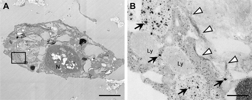 Figure S2 TEM images of cells after GO scaffold implantation.Notes: (A) Blackened cell around the newly formed bone in rat. (B) Higher magnification of the boxed area in (A). Flake-like (arrowheads) and cluster-like structures (arrows) were observed in the cell body. Scale bars represent 2 μm (A) and 200 nm (B).Abbreviations: GO, graphene oxide; Ly, lysosome; N, nuclei; TEM, transmission electron microscope.