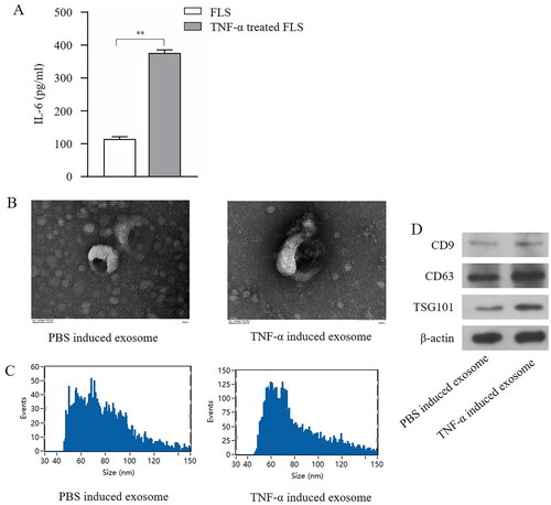 Figure 1. Content of IL-6 in culture supernatant of FLS and characteristics of exosomes derived from FLS induced by TNF-α or PBS were quantified and characterised by nanoparticle characterization instrument, transmission electron microscope and Western blot. (A) The changes of content of IL-6 in culture supernatant of FLS stimulated by PBS or TNF-α for 48h. (B) Transmission electron microscope pictures of exosome. (C) Particle size distribution of exosomes. (D) The protein of CD9, CD63 and TSG101 in exosome were examined by Western blot. **p < 0.01.