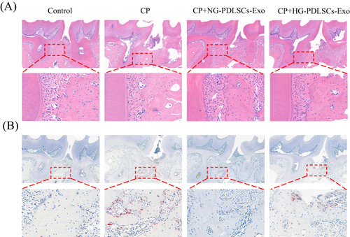 Figure 5 Histological analysis of chemical staining. (A) Representative images of H&E staining. Scale bar: 200 μm.The red box represents the region of interest used to enlarge the view. Scale bar: 50 μm. (B) Representative images of TRAP staining. Scale bar: 200 μm. The red box represents the region of interest used to enlarge the view. Scale bar: 50 μm.