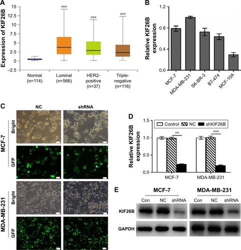 Figure 1 Lentivirus-mediated gene knockdown of KIF26B in breast cancer cells.