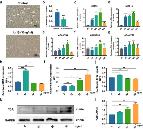 Figure 3. Establishment of nucleus pulposus (NP) cells injury model in vitro. (a) Representative images of cells in normal medium and cells treated by IL-1β (30 ng/ml); (b) Analysis of the cell viability between cells in normal medium and cells treated by IL-1β (30 ng/ml); (c-f) Quantitative analysis of mRNA expression of IDD-related proteins in NP cells treated by IL-1β (30 ng/ml) at indicated time points; (h) qRT-PCR for the expression of NPY mRNA in Rat NP cells treated by IL-1β with indicated concentrations; (i) qRT-PCR for the expression of Y2R mRNA in Rat NP cells treated by IL-1β with indicated concentrations; (j) ELISA analysis for the secretion the content of NPY in cell cultural supernatant of Rat NP cells treated by IL-1β with indicated concentrations; (k) Western blotting analysis for the expression of Y2R protein in Rat NP cells treated by IL-1β with indicated concentrations; (l) The quantitative and statistical analysis of the western blot band (Y2R)