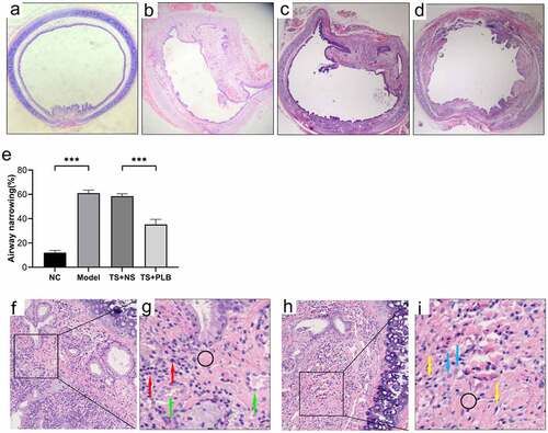 Figure 1. Pathological changes in the airway lumen of the four groups and the stenosis is attenuated by PLB in rat TS model. Upon euthanization, the tracheal tissues were prepared and stained with H&E (a-d,f-i). Representative images of NC (a), model (b), TS+NS (c) and TS+PLB (d) groups. (f-i) is the pathological section of the model group. The magnification of (g,i) is 40 × . (g,i) is a small part of (f,h). Angiogenesis (green arrows) is observed in the submucosal layer with numerous inflammatory cells (red arrows) infiltrated beneath the airway epithelium. The number of fibroblasts (blue arrows) is increased, and fibrocytes (yellow arrows) are dispersed in the thickened submucosa with collagen deposition stained in pink (black circle). The degrees of stenosis are presented in (e).Data represent the mean ± SD of the study groups, n = 6 per group. **P < 0.05, **P < 0.01,*** P < 0.001.The degree of stenosis was measured based on the following equation: (1-mucosal surface lumen area/tracheal cartilage lumen area) × 100