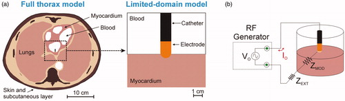 Figure 1. (A) Full thorax model and limited-domain model used to study RF cardiac ablation. (B) In the limited-domain model only a portion of the electrical circuit between active electrode and dispersive electrode is considered. The part of the total power delivered by the RF generator (P0 = V0 × I0) that is applied to a limited-domain model is PMOD = I02 × ZMOD.