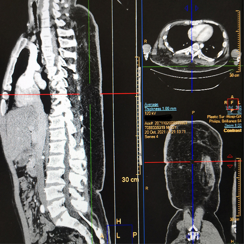 Figure 2 CT imaging.