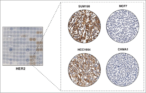 Figure 2. Immunocytochemical staining of HER2. The left panel shows a CMA slide stained with a HER2 antibody. The panel on the right shows a magnified view of 4 representative cell lines with different levels of HER2 staining. Very strong cell membrane staining was observed in 2 HER2 amplified breast cancer cell lines SUM190 and HCC1954. However, negative staining patterns were observed in 2 HER2 negative luminal breast cancer cell lines, MCF7 and CAMA1.