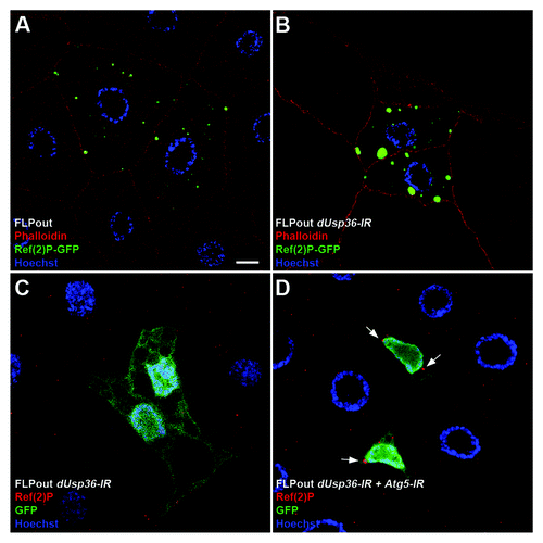 Figure 6. The Ref(2)P/p62 protein accumulates in dUsp36 silenced cells. Confocal sections of fat body cells after FLPout induced expression of the Ref(2)P-GFP fusion protein in wild-type (A) or dUsp36 knock-down cells (B). The size and intensity of Ref(2)P-GFP dots are enhanced by dUsp36 inactivation. Expression of the endogenous Ref(2)P protein in fat body cells expressing the dUsp36-IR transgene alone (C) or in combination with Atg5-IR (D) shows that, as ubiquitinated proteins, the endogenous Ref(2)P protein accumulates in Atg5; dUsp36 double knockout cells. Genotypes: (A) y,w,hsFLP/+; UAS-Ref(2)P-GFP/+, Ac > CD2 > Gal4/+ (B) y,w,hsFLP/+; UAS-Ref(2)P-GFP,UAS-dUsp36-IR/+, Ac > CD2 > Gal4/+ (C) y,w,hsFLP/+; UAS-GFPnls,UAS-dUsp36-IR/+, Ac > CD2 > Gal4/+ (D) y,w,hsFLP/UAS-Atg5-IR; UAS-GFPnls,UAS-dUsp36-IR/+, Ac > CD2 > Gal4/+. Scale bar: 10 µm.
