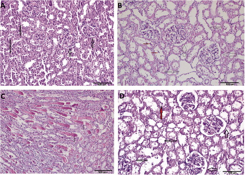 Figure 1. Hematoxylin–eosin (H&E ×200) kidney stained sections showed normal structure of the renal cortex and medulla of Sham operated group (A). Thin arrows show tubules and thick arrows show glomerulus. This was markedly affected in the renal ischemia-reperfusion group (B) with severe tubular dilatation (thin arrow), moderate to severe tubular cell degeneration and necrosis (TCDN; red (small) arrows), and severe dilatation of Bowman’s space (DBS; thick arrows). In addition to this, the number of generated hyaline cast was high (C). The normal structure was somewhat regained in the syringic acid pretreated group (D): mild DBS (thick arrows), mild to moderate TD (thin arrows) and minimal TCDN (red (grey) arrows).