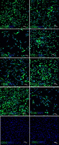 Figure 2. Surface antigen characteristics of BMMSCs at different passages. Immunoflourescence staining results showed that BMMSCs at different passages expressed antigens CD44, CD29, ICAM-1, CD71, CD73, CD90, CD105 and SSEA-4, but not antigens CD31 and CD34.