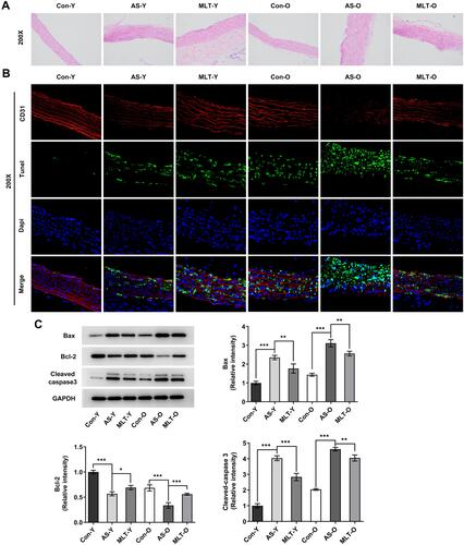 Figure 1 MLT alleviates vascular aging-related endothelial injury in ApoE−/− mice. Young-male ApoE−/− mice and aged-male ApoE−/− mice were received high fat diet (HFD) to induce atherosclerosis and intraperitoneally injected with melatonin (MLT; 20 mg/kg/d) for treatment. (A) H&E staining of intima of aorta, magnification×200. (B) TUNEL staining of intima of aorta, magnification×200. (C) Western blot and statistical analysis of protein expression of Bax, Bcl-2 and cleaved caspase3. N=3. *, **, ***p<0.05, 0.01, 0.001.