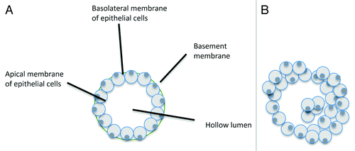 Figure 3. Diagram of typical acini formed by iMMECs. (A) When grown in 3D culture conditions, wild-type iMMECs form spherical acini with a completely hollow lumen, surrounded by a single layer of polarized epithelial cells. (B) Overexpression of PAK4 leads to formation of acini, which lack a completely hollow, with a thicker outer layer of epithelial cells, and leads to disruption in cell polarity.