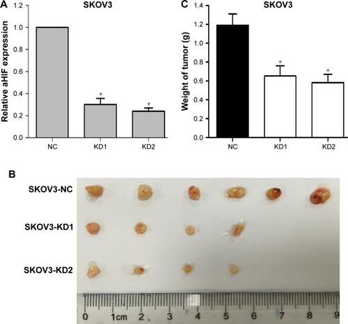 Figure 5 aHIF knockdown inhibits EOC tumor growth in vivo.