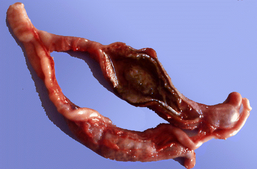 Figure 4.  Turkey caeca, examined at 8 days p.i. with caecal content of positive ducks. Note severe thickening of the caecal wall and clearly caseous caecal content.