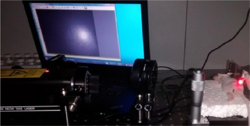 Figure 4 The experimental setup during in vivo measurements.