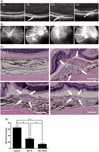 Figure 4. (A) OCT images of intraretinal layers cross-section (a) before photocoagulation; (b) 7 days after photocoagulation; (c) 14 days after photocoagulation; and (d) 21 days after photocoagulation. (B) FFA images: (a) before photocoagulation; (b) 7 days after photocoagulation; (c) 14 days after photocoagulation; and (d) 21 days after photocoagulation. (C) Histological images: (a) normal group without laser induction; (b) control group with 35 days after laser induction; (c) Bev-S group with 28 days after administration; and (d) Bev-MVLs group with 28 days after administration (white arrows indicate CNV lesion margins, scale bar, 50 μm). (D) BN rats treated with either Bev-S or Bev-MVLs had significantly thinner neovascular membranes than those in the control group (*p < .05, **p < .01, mean ± SD, n = 5).