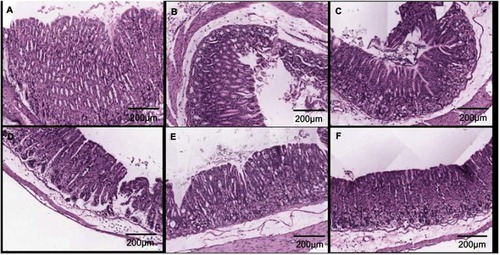 Figure 9 Pathological analysis of gastric tissues after distinct treatments using H&E staining assay after acetic acid induction. Magnification 100×. (A) Normal control. (B) Acetic acid induction. (C) A/BS MCs treatment. (D) RH treatment. (E) CA/BS MCs loading RH treatment. (F) Cat27-CA/BS MCs loading RH treatment.Abbreviations: A/BS MCs, alginate/barium sulfate microcapsules; RH, ranitidine hydrochloride; CA/BS MCs, chitosan alginate/barium sulfate microcapsules.