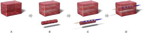 Figure 3. Ingrowth-ablation with stent-wire contact model. Tissue blocks measuring 50 × 30 × 30 mm3 were sectioned from the bovine livers (A), and a 10-mm diameter columnar structure was hollowed out from the center of the block using a cork borer (B). The guidewire and ablation catheter were inserted into the chink between the stent and the columnar tissue structure (creating a situation where the electrodes are in contact with the stent-metal wire) (C), which was refitted into the hollowed-out block (D).