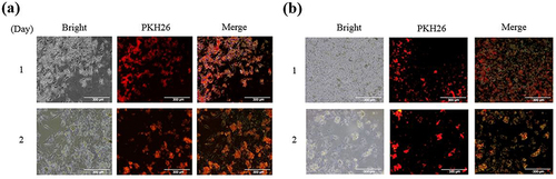 Figure 4 Fluorescent staining of cells under the field of 40× magnification. (a and b) The B16F10 was co-incubated for 24 hours with PKH26-stained ANPs (0.42 and 0.84 mM).