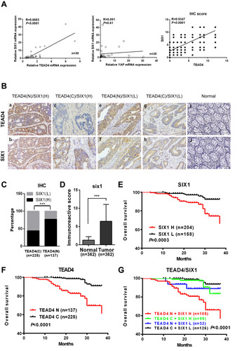 Figure 4 TEAD4 and SIX1 are the prognostic markers for the colorectal cancer. (A) Correlation between TEAD4 and SIX1 mRNA levels in 30 primary human CRC samples. The Spearman rank coefficient was used as a statistical measure of correlation. (B) Immunohistochemical analysis of TEAD4 and SIX1 in the stage I–III colorectal cancer samples and normal epithelial tissue. Representative images of TEAD4 nuclear expression (N) (a)/SIX1 high expression (H) (B), low level/cytoplasmic expression of TEAD4 (C) (c)/SIX1 high expression (H) (D), TEAD4 nuclear expression (N) (e)/SIX1 low expression (L) (F), low level/cytoplasmic expression of TEAD4 (C) (G) /SIX1 low expression (L) (h), TEAD4 (i) and SIX1 (j) in normal epithelial tissue were shown. (C) Association of TEAD4 nuclear expression and SIX1 expression in 362 stage I–III CRC samples. χ2 test was used to evaluate the association. ***P<0.001. (D) The Mann–Whitney U-test was performed to assess statistical significance of SIX1 expression levels in CRC and normal epithelia. (E) Kaplan–Meier plots of overall survival of the stage I–III CRC patients stratified by SIX1 expression. Log Rank test was performed to assess statistical significance. (F) Kaplan–Meier plots of overall survival of the stage I–III CRC patients stratified by nuclear TEAD4 expression. Log Rank test was performed to assess statistical significance. (G) Kaplan–Meier plots of overall survival of the stage I–III CRC patients stratified by combination of SIX1 and nuclear TEAD4 expression. Log Rank test was performed to assess statistical significance.