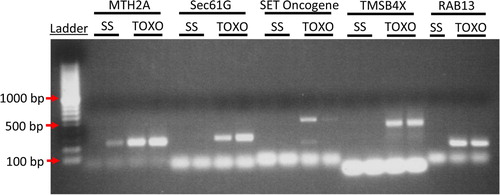 Fig. 2 To confirm the microarray data PCR analysis was performed for highly represented genes in Toxo compared to SS ELVs. cDNA from 2 experimental replicates of SS and Toxo ELVs RNA preparations was used to confirm the presence of mRNA transcript for Metallothionein 2A (MTH2A), protein transport protein Sec61 subunit gamma (Sec61G), SET nuclear oncogene (SET), thymosin beta 4, X-linked (TMSB4X), and Rab 13. (Please see Supplementary File for primer sets). The ethidium bromide–treated PCR products were run on a 2% agarose gel and visualized with UV light. Bands of the expected base-pair size are present for these representative mRNA in the Toxoplasma-infected ELVs and are absent from the ELVs of the SS cells except for MTH2A, which shows limited expression in one of the SS samples.