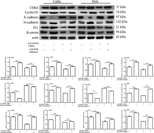 Figure 6. The protein levels of the EMT-related process were examined by Western blotting. The expression of CDK6, cyclin D1, E-cadherin, N-cadherin, P21 and β-catenin in (a) HeLa and (b) CaSki cells transfected with si-circCDK6 and miR-449a inhibitor. The sample size was 40 μg/lane. *p < 0.05, **p < 0.01 and ***p < 0.001 vs. respective control.