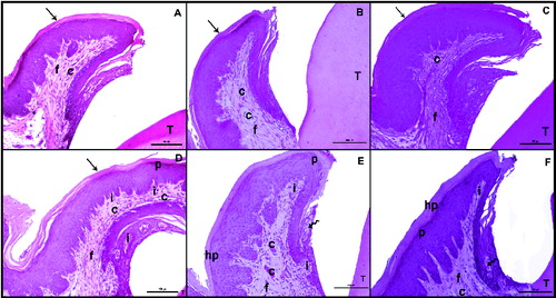 Figure 1. Hematoxylin–eosin (H&E) staining after the induction of diabetes by streptozotocin. Histological images of the non-diabetic (control) rats: on day 7 (A), day 14 (B), day 21 (C); and diabetic rats: on day 7 (D), day 14 (E), day 21 (F). Tooth (T); corneum (arrow), capillary (C), fibroblasts (f), collagen (arrowhead), inflammatuar cells (i), parakeratosis (p), hyperkeratosis (hp), interepthlium inflammatory cell (curved arrow), disorganized structure of collagen fibres (*); scale bar: 50 μm.