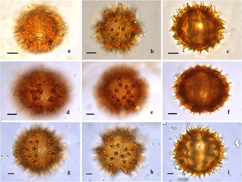 Figure 3. Light microscopy of Centauropsis Bojer ex DC. pollen grains. A‒C. Centauropsis fruticosa var. baronii Humbert. A. Detail of the colporus, endoaperture and surface, equatorial view. B. Apertures 3-colporate, long and acute apices and apocolpium surface. C. Optical section, equatorial view. D‒F. Centauropsis perrieri Humbert. D. Detail of the colporus, endoaperture and surface, equatorial view. E. Apertures 3-colporate, long and acute apices and apocolpium surface. F. Optical section, equatorial view. G‒I. Centauropsis rhaponticoides Drake. G. Detail of the colporus, endoaperture and surface, equatorial view. H. Apertures 3-colporate, long and acute apices and apocolpium surface. I. Optical section, equatorial view. Scale bars – 10 μm (A‒C), 8 μm (D‒I).