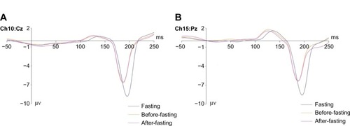 Figure 4 The significant effect of fasting on the N1 component.