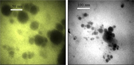 Figure 1 Transmission electron microscopy photograph of a Q10-loaded solid lipid nanoparticle.