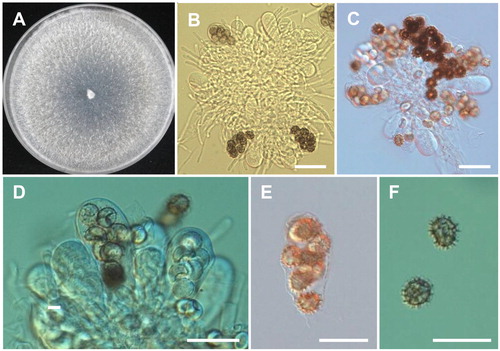 Figure 5. Morphology of Ascodesmis sphaerospora CNUFC-DDS14-1. A, Colony on potato dextrose agar; B–E, Asci; F, Ascospores (Scale bars: B–F = 20 μm).