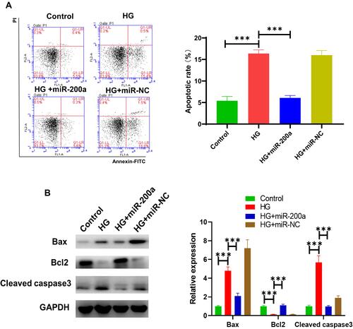 Figure 5 Effect of miR-200a on apoptosis and apoptosis-related genes in high glucose (HG)-treated HRMECs. (A) The apoptosis rate was detected in cultured HRMECs in normal glucose (NG), high glucose (HG), HG+miR-200a and HG+miR-NC. Summary of apoptotic rates in different groups is provided. HG treatment significantly increased apoptotic rate, while the apoptosis was improved by miR-200a treatment. n = 5. (B) Role of miR-200a on the expression of apoptosis-related genes, including Bax, Bcl-2 and caspase-3, in HG-treated HRMECs by Western blotting. miR-200a treatment leads to pro-apoptosis gene down-regulation and anti-apoptosis gene up-regulation. ***P<0.001.