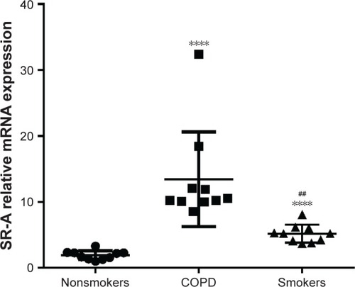 Figure 1 SR-A mRNA expression in AMs.