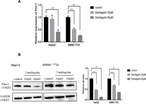 Figure 3 Ventilagolin reduces Pim-1 expression in HCC cells. (A and B) HepG2 and SMMC-7721 cells were treated with 30 μmol/L and 60 μmol/L Ventilagolin, and the mRNA and protein levels of Pim-1 were determined by qRT-PCR and Western blot using GAPDH as an internal reference. The relative expression levels were quantified by ProteinSimple analysis software. Data are expressed as mean ± SEM from three independent experiments. ** indicates significant difference at P < 0.01 as compared to the control group.