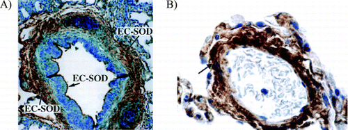Figure 4. Pulmonary distribution of extracellular superoxide dismutase. Histochemical localization of the superoxide dismutases in human lung using rabbit anti‐human extracellular superoxide dismutase extracellular superoxide dismutase (ECSOD) antibodies. ECSOD labeling of a small airway (A) and small pulmonary vessel (B). Strong labeling is seen in the airway and vessel walls (arrows). (A) Reprinted by permission from Ref. Citation[[206]] and (B) reprinted by permission from Ref. Citation[[207]]. (Full color version available online.)